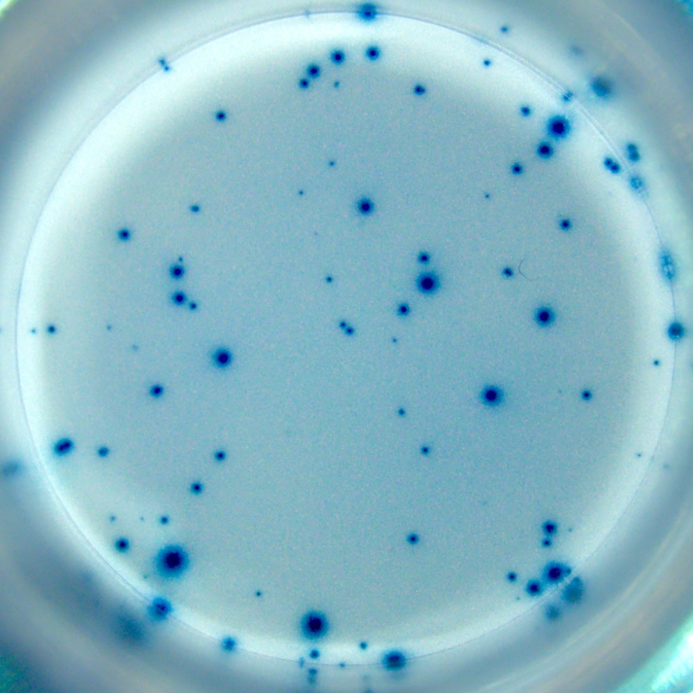 T cell ELISPOT