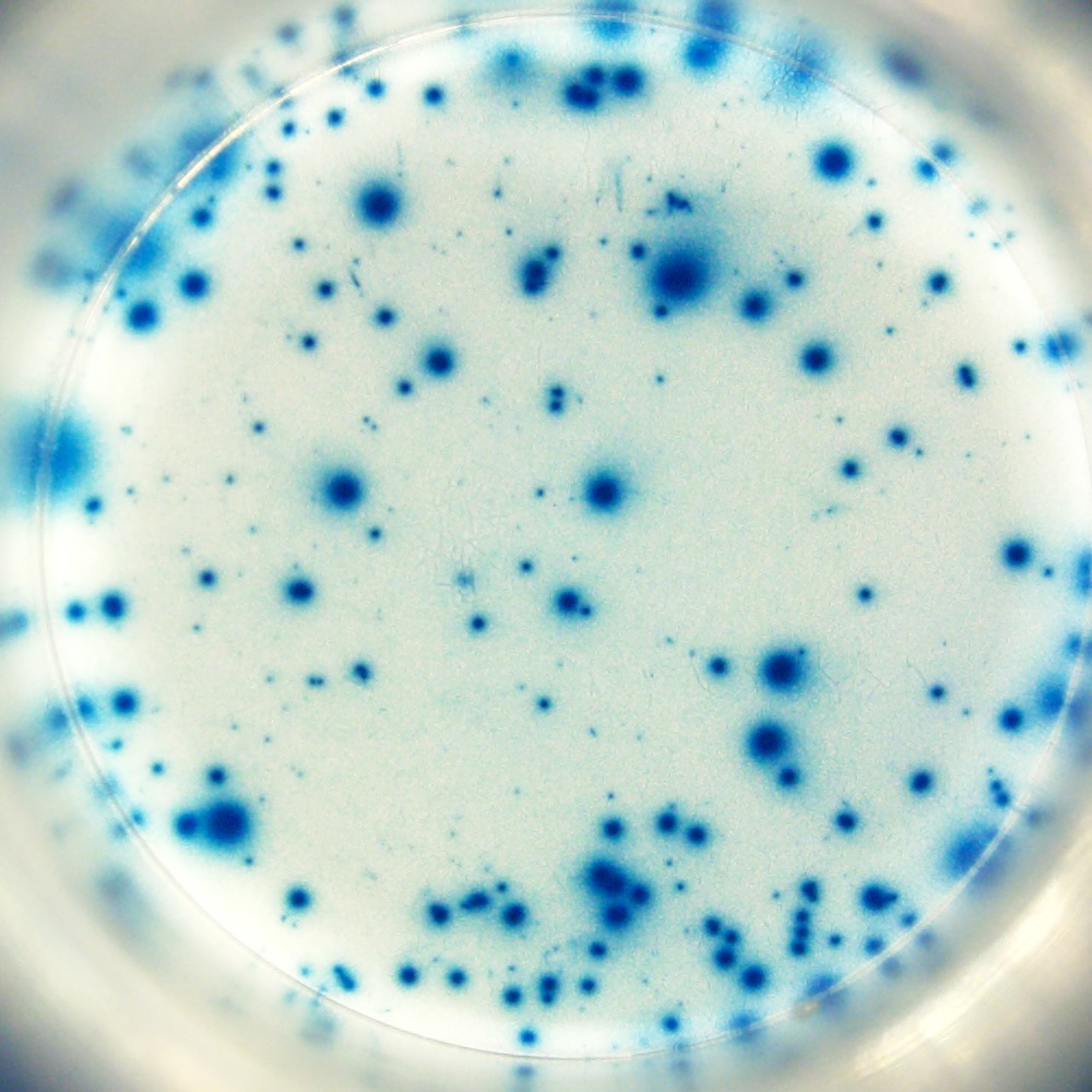 B cell ELISPOT