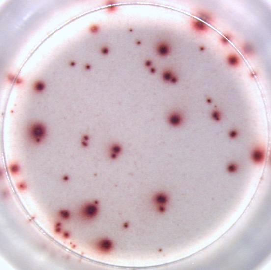 Human IFN-gamma ELISPOT