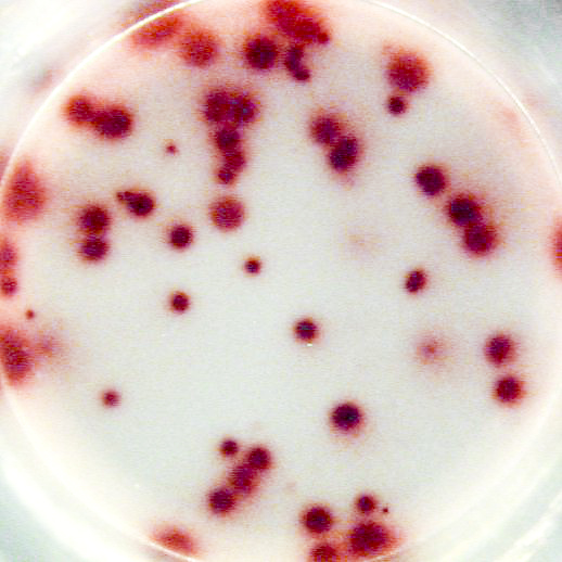 Tetanus toxoid specific IgG secreting cells