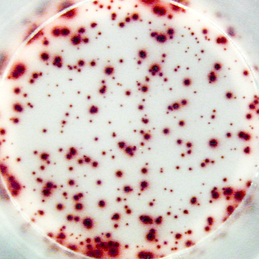 Total number IgG secreting cells