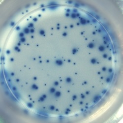 human IFN-gamma