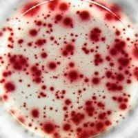 Human IFN-gamma ELISPOT assay